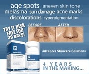 Diminish Dark Spots and Skin Discolorations In 2 Weeks!